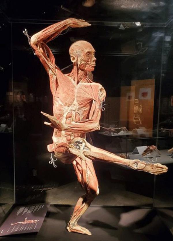 نمایشگاه جنجالی دنیای بدن,نمایشگاه دنیای بدن