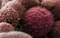 تعامل دو ژن عامل متاستاز سرطان پانکراس,سرطان پانکراس