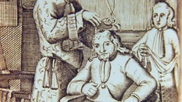 جراحی جمجمه,جراحی جمجمه در 1600 سال پیش