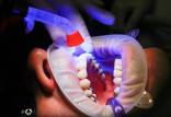 اولین اطلس کامل سلولی دندان‌های انسان,دندان انسان