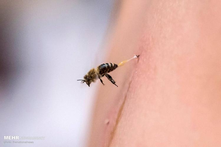 تصاویر درمان روماتیسم با نیش زنبور در مصر,عکس های درمان روماتیسم با نیش زنبور,تصاویر درمان روماتیسم در مصر