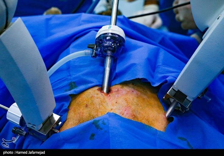 تصاویر عمل جراحی رباتیک درا یران,عکس های اولین عمل جراحی رباتیک در کشور ایران,تصاویر عمل جراحی رباتیک
