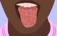خشکی دهان,تاثیر میزان قند خون در ایجاد خشکی دهان