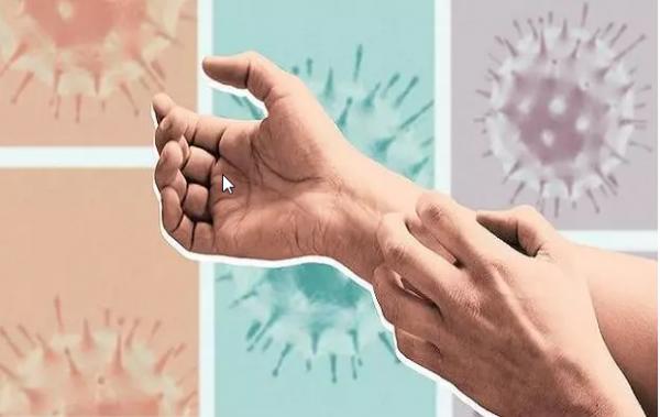 مشکلات پوستی مشکلات پوستی,کروناویروس