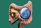سلامت روده,افزایش طول عمر با بهبود سلامت روده