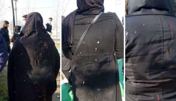 اسیدپاشی وحشتناک به زنان تهرانی در شهرک مریم,اسیدپاشی به زنان در تهران