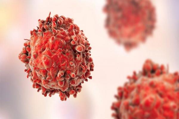 سرطان پوست,درمان سرطان پوست