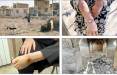 شیوع یک بیماری انگلی بیخ گوش تهران,بیماری انگلی در ایران