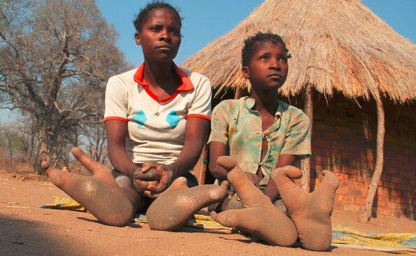 قبیله‌ای آفریقایی با پاهای عجیب,عکس پاهای عجیب