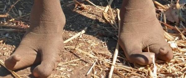 قبیله‌ای آفریقایی با پاهای عجیب,عکس پاهای عجیب