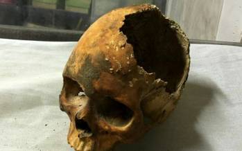 عکس | رونمایی از جمجمه نادر شاه پس از ۲۷۰ سال جمجمه نادرشاه, رونمایی از جمجمه نادر شاه