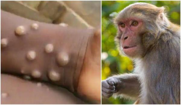 آبله میمونی,کشف دو سویه جدید آبله میمونی در آمریکا