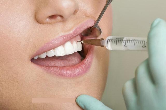 افزایش ظرفیت دندانپزشکی,جزئیات افزایش ظرفیت دندانپزشکی