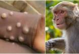 آبله میمونی,هشدار سازمان بهداشت جهانی خطر آبله میمونی در جهان