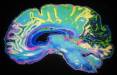 مغز,مسیر عامل انتقال ریزذرات مضر از ریه‌ها به مغز