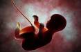 سقط جنین,ممنوعیت سقط جنین در آمریکا