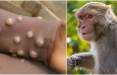 آبله میمونی,کشف دو سویه جدید آبله میمونی در آمریکا