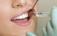 افزایش ظرفیت دندانپزشکی,جزئیات افزایش ظرفیت دندانپزشکی