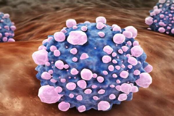 متاستاز سرطان پانکراس,کشف عامل مهم در ابتلا به متاستاز سرطان پانکراس