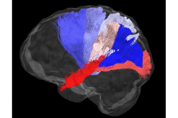 مغز,طراحی الگوریتمی جدید برای تشخیص اتصالات مغزی