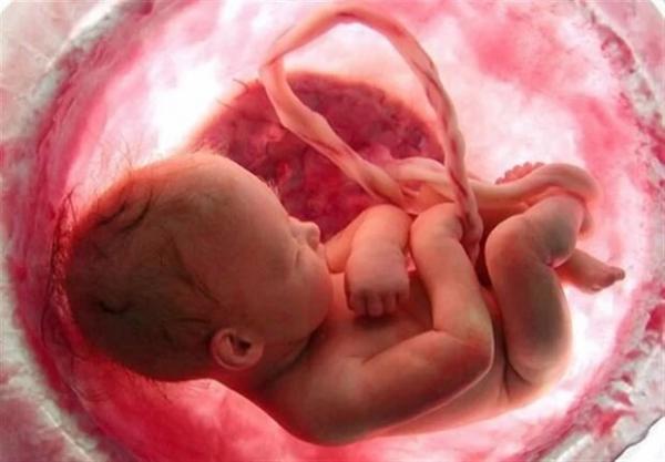 سقط جنین,ناباروری