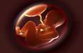 سقط جنین,پیش‌بینی سقط جنین با تجزیه و تحلیل ژنوم