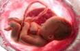 سقط جنین,خطر سقط جنین در تابستان