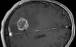 شناسایی سریع تومورهای مغزی به کمک هوش مصنوعی,کمک هوش مصنوعی به شناسایی تومور