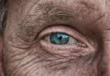 آلزایمر,پیش‌بینی احتمال ابتلا به آلزایمر با بررسی تغییرات شبکیه