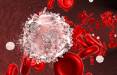 سرطان خون,شناسایی دو مولکول موثر برای درمان سرطان خون
