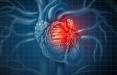 قلب,بهبود عملکرد استنت‌های قلبی با دگزا و نانوذرات