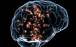 مغز,اثرگذاری مصرف استروئیدها بر ساختار مغز