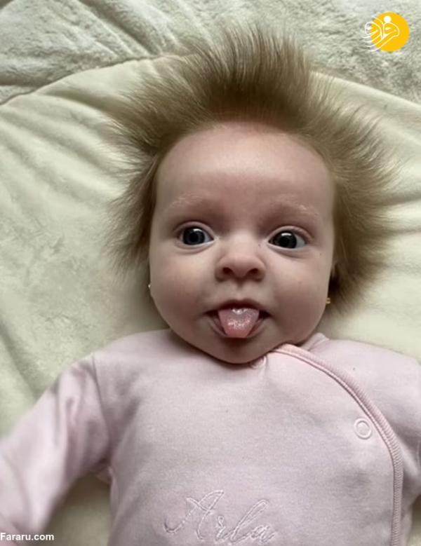 نوزادی در ولز,موهای منحصربفرد یک دختر در ولز