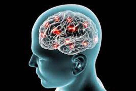 بیماری آلزایمر,مرگ سلولهای مغزی