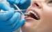 دندانپزشکی,ابلاغ تعرفه دندانپزشکی برای اولین بار در کشور