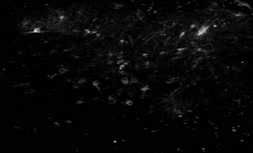 فیلم/ پیوند نورون‌های انسان را به مغز موش