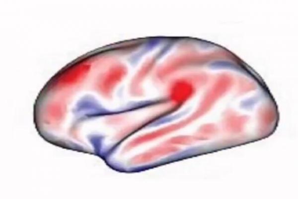 گوگل مپ مغز,ابداع نرم افزاری برای تجزیه و تحلیل نقشه‌های مغز