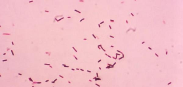 باکتری,کشف راز خواب زمستانی باکتری ها