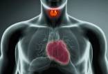 سرطان تیروئید,افزایش خطر ابتلا به بیماری قلبی در افراد مبتلا به سرطان تیروئید