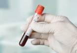 آزمایش خون,تشخیص سریع انواع مختلف سرطان با این آزمایش خون