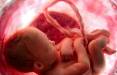 زایمان,تاثیر نوع زایمان در ذخیره‌سازی خون بندناف نوزاد