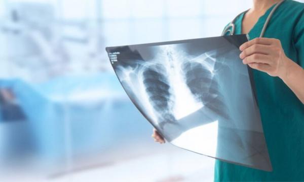 رادیوگرافی,پیش بینی خطر بیماری های قلبی عروقی فقط با یک رادیوگرافی