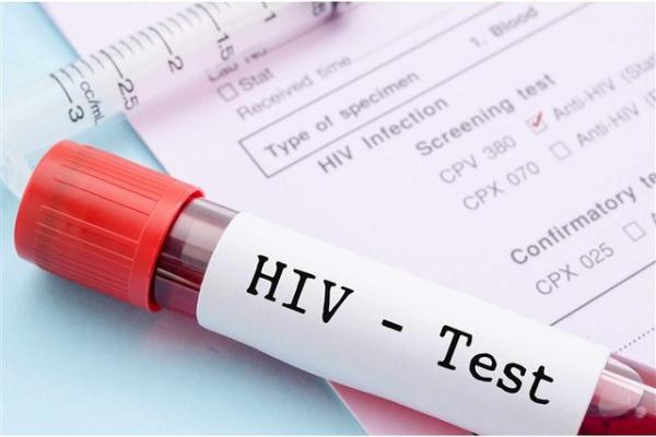 HIV,وضعیتHIVدرایران