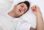 آپنه خواب,روش جدید برای آپنه خواب