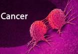 سرطان پروستات,شایع ترین سرطان درمردان