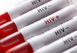 بیماری HIV,مراقبت و درمان HIV
