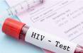 HIV,وضعیتHIVدرایران