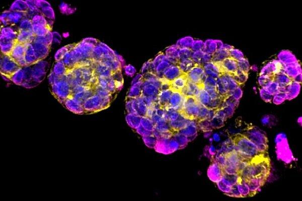 نابودی سرطان,کشف روشی برای از بین بردن سرطان با استفاده از DNA