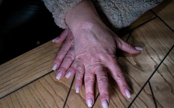 زن اوکراینی زن اوکراینی, شکنجه گاه روسها