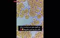 فیلم | گلبول‌های سفید چگونه باکتری‌ را پیدا می‌کنند؟